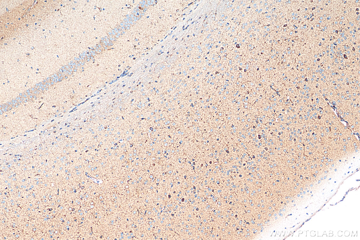 Immunohistochemistry (IHC) staining of mouse brain tissue using Pyruvate Carboxylase Monoclonal antibody (66615-1-Ig)