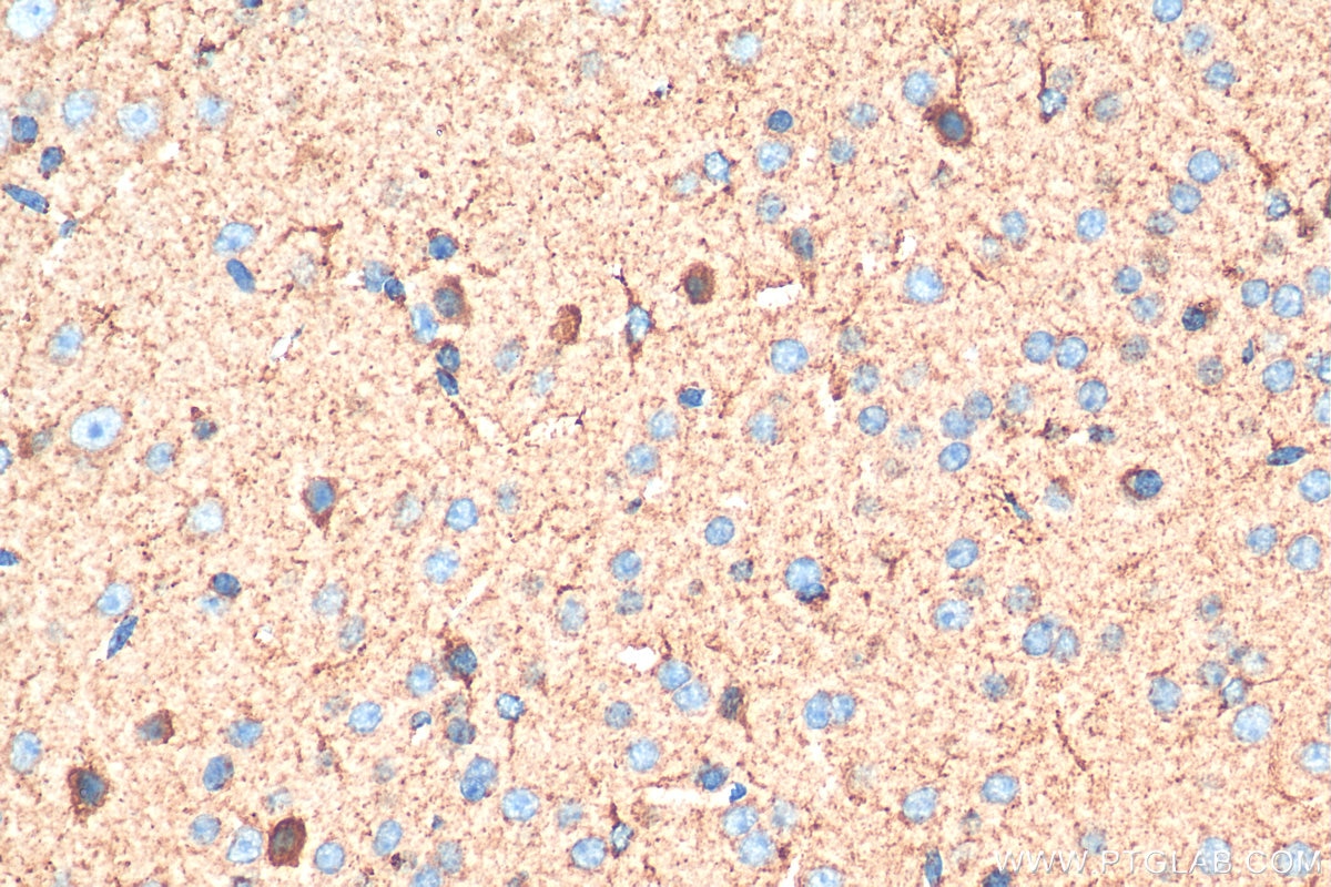 Immunohistochemistry (IHC) staining of mouse brain tissue using Pyruvate Carboxylase Monoclonal antibody (66615-1-Ig)