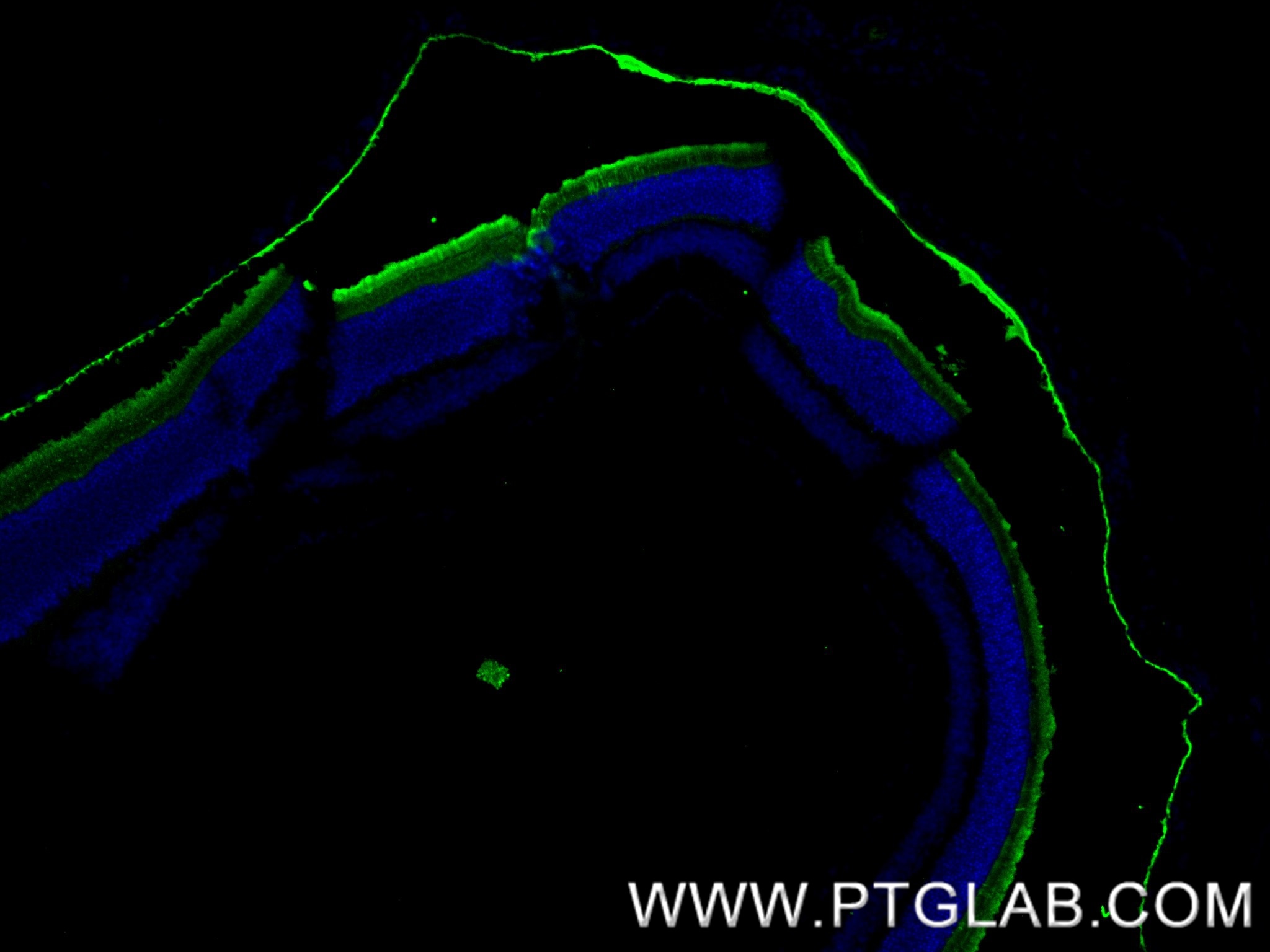 Immunofluorescence (IF) / fluorescent staining of mouse eye tissue using PCARE Recombinant antibody (83364-4-RR)