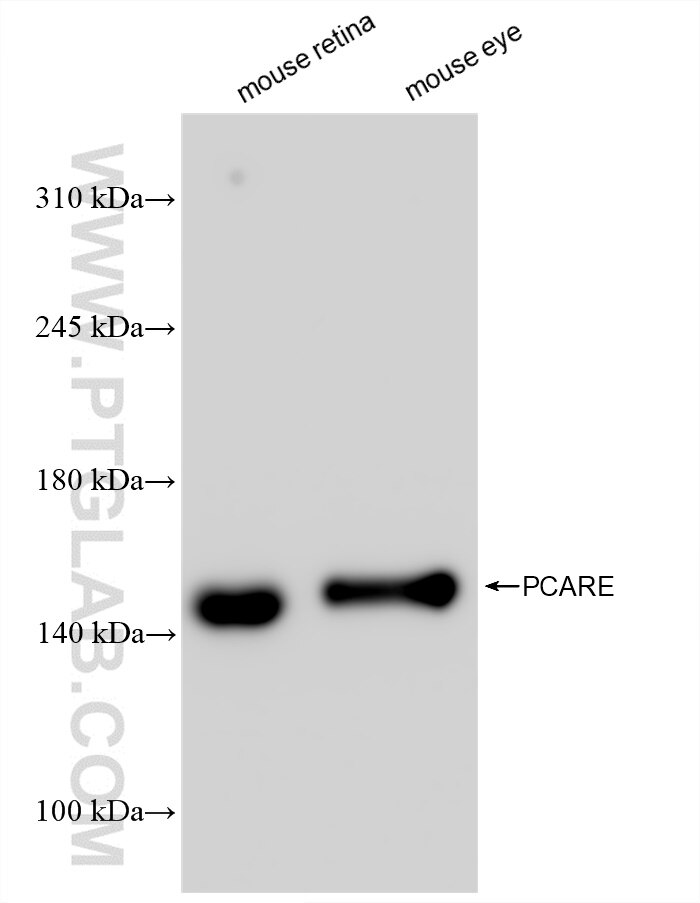 Western Blot (WB) analysis of various lysates using PCARE Recombinant antibody (83364-4-RR)