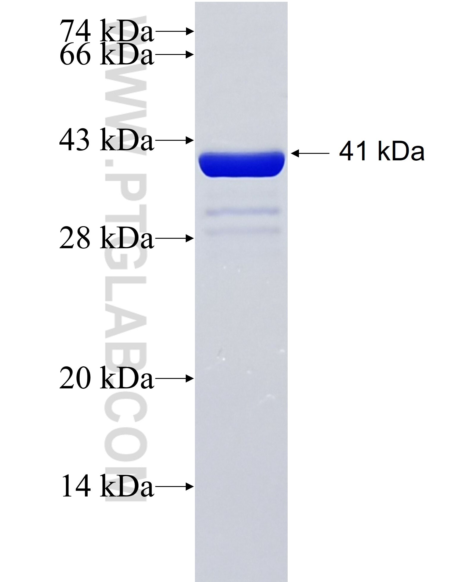 PCARE fusion protein Ag34774 SDS-PAGE