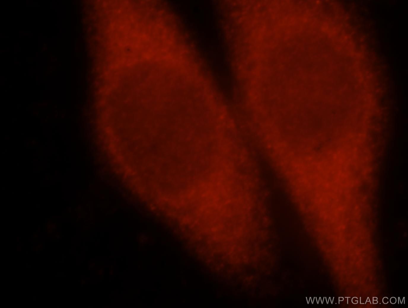Immunofluorescence (IF) / fluorescent staining of HeLa cells using PCBD1 Polyclonal antibody (15702-1-AP)