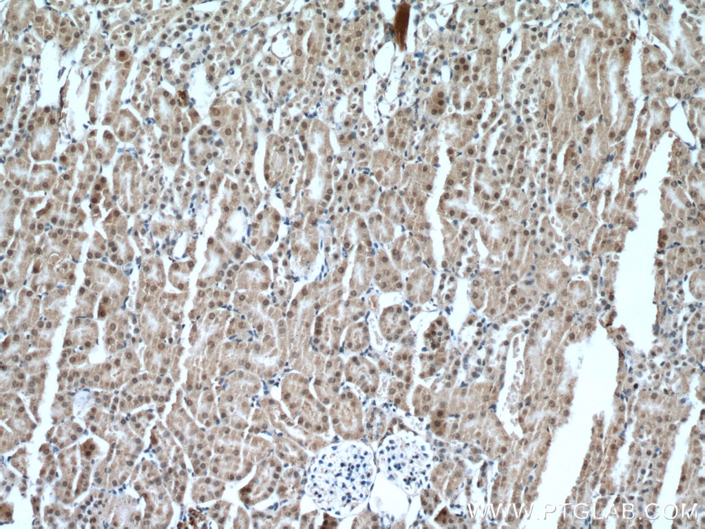 Immunohistochemistry (IHC) staining of mouse kidney tissue using PCBD1 Polyclonal antibody (15702-1-AP)