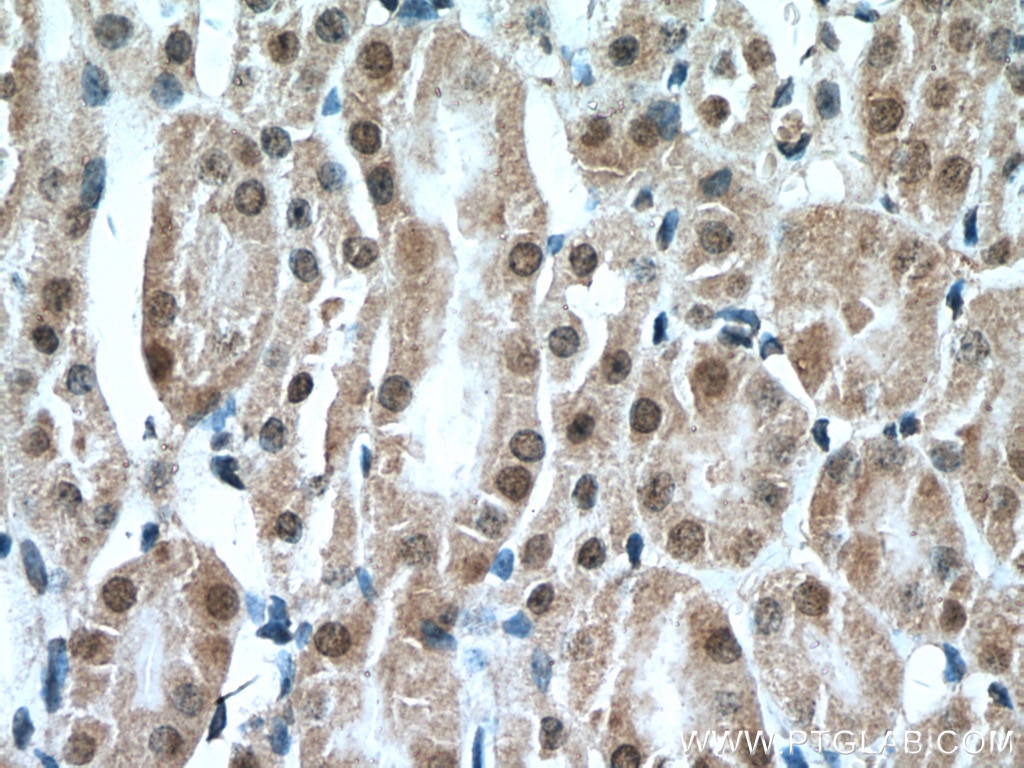 Immunohistochemistry (IHC) staining of mouse kidney tissue using PCBD1 Polyclonal antibody (15702-1-AP)
