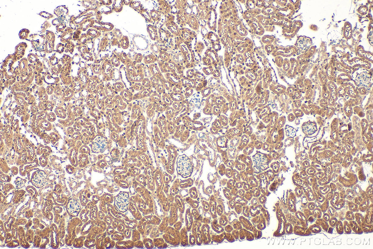 Immunohistochemistry (IHC) staining of mouse kidney tissue using PCBD1 Polyclonal antibody (15702-1-AP)