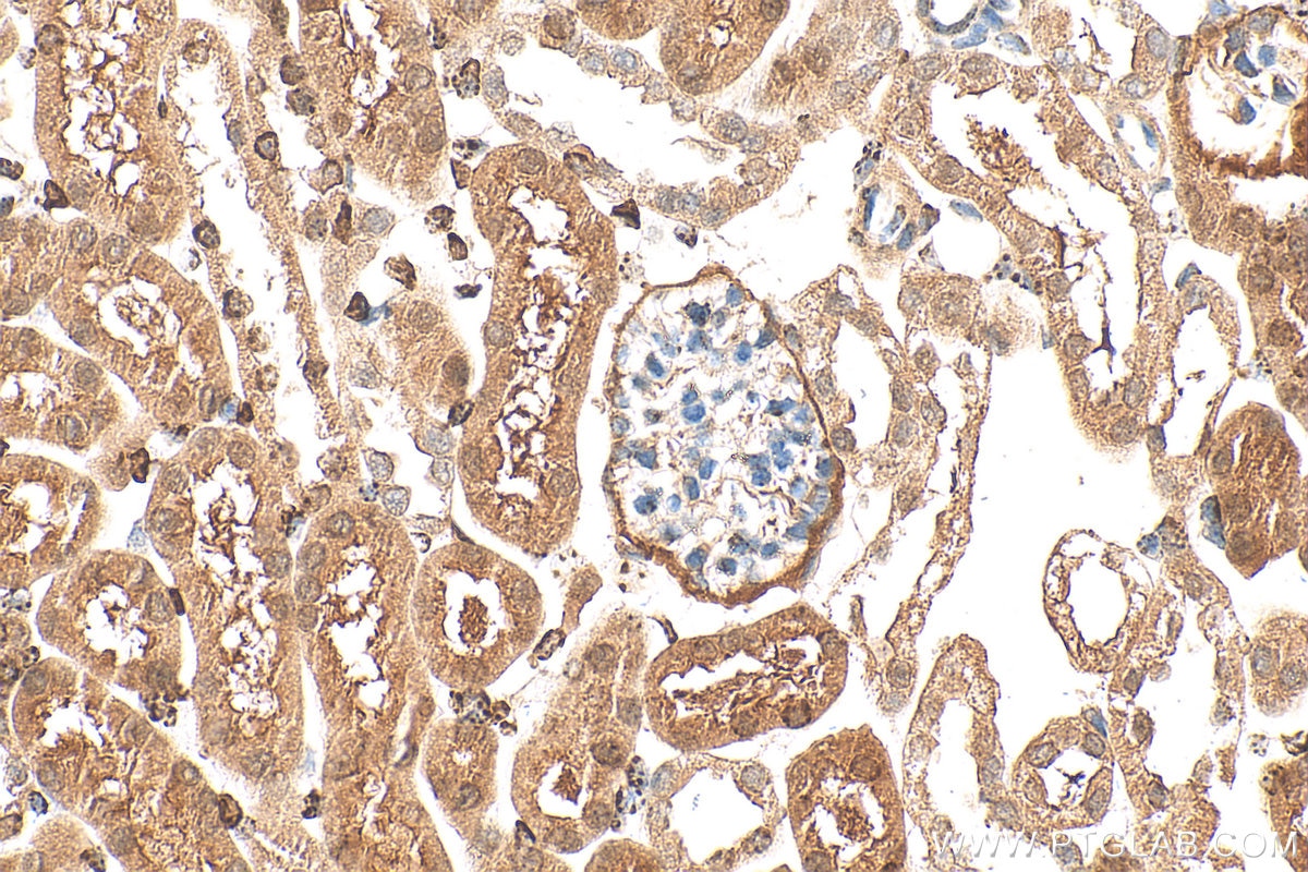 Immunohistochemistry (IHC) staining of mouse kidney tissue using PCBD1 Polyclonal antibody (15702-1-AP)