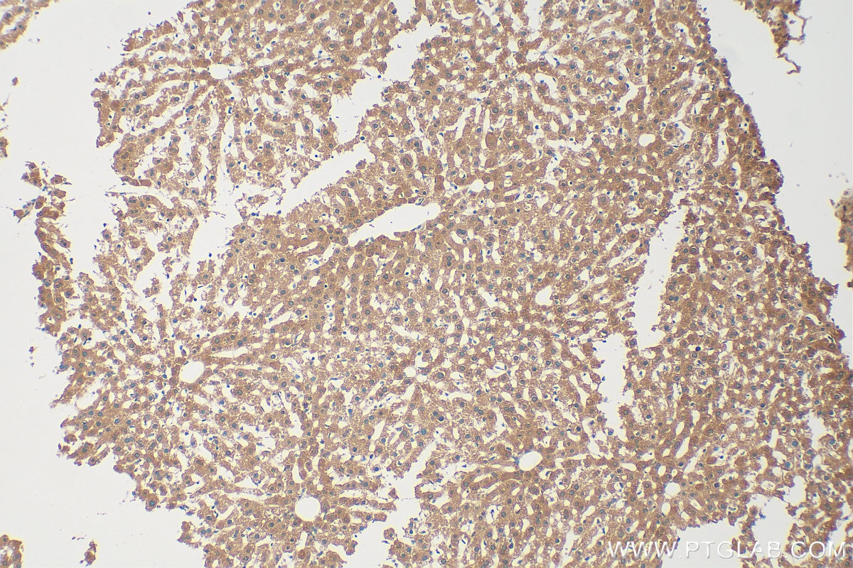 Immunohistochemistry (IHC) staining of mouse liver tissue using PCBD1 Polyclonal antibody (15702-1-AP)