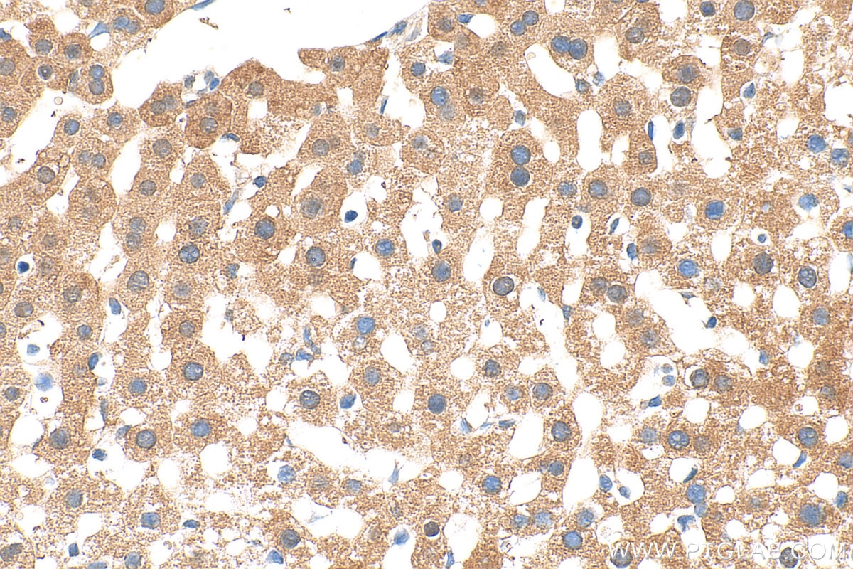 Immunohistochemistry (IHC) staining of mouse liver tissue using PCBD1 Polyclonal antibody (15702-1-AP)