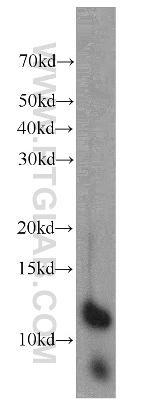 Western Blot (WB) analysis of mouse pancreas tissue using PCBD1 Polyclonal antibody (15702-1-AP)