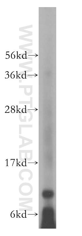 Western Blot (WB) analysis of mouse pancreas tissue using PCBD1 Polyclonal antibody (15702-1-AP)