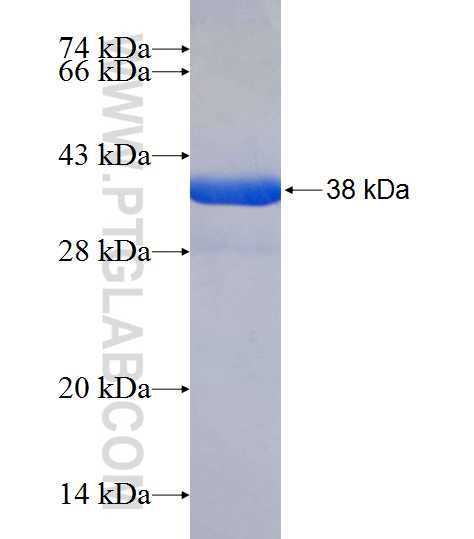 PCBD1 fusion protein Ag8331 SDS-PAGE