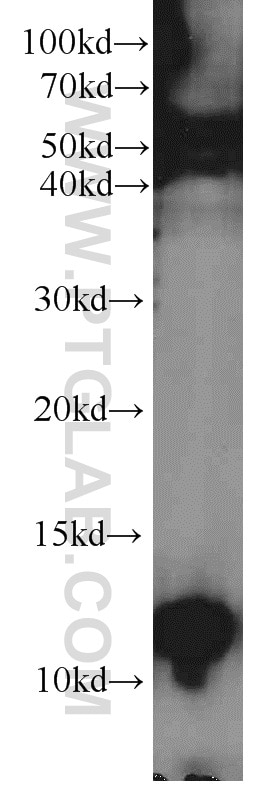 Western Blot (WB) analysis of human skeletal muscle tissue using PCBD2 Polyclonal antibody (11958-1-AP)