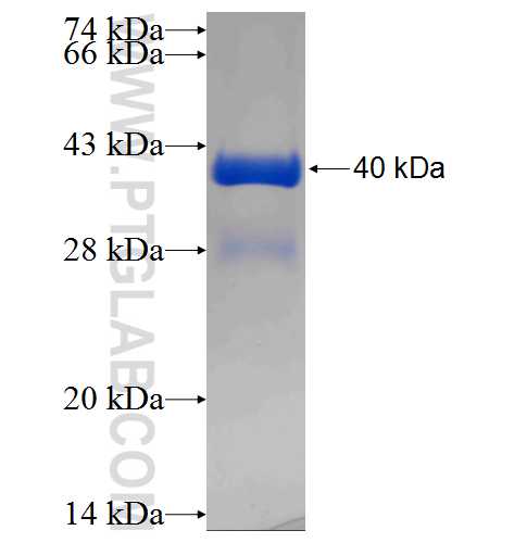 PCBD2 fusion protein Ag2562 SDS-PAGE