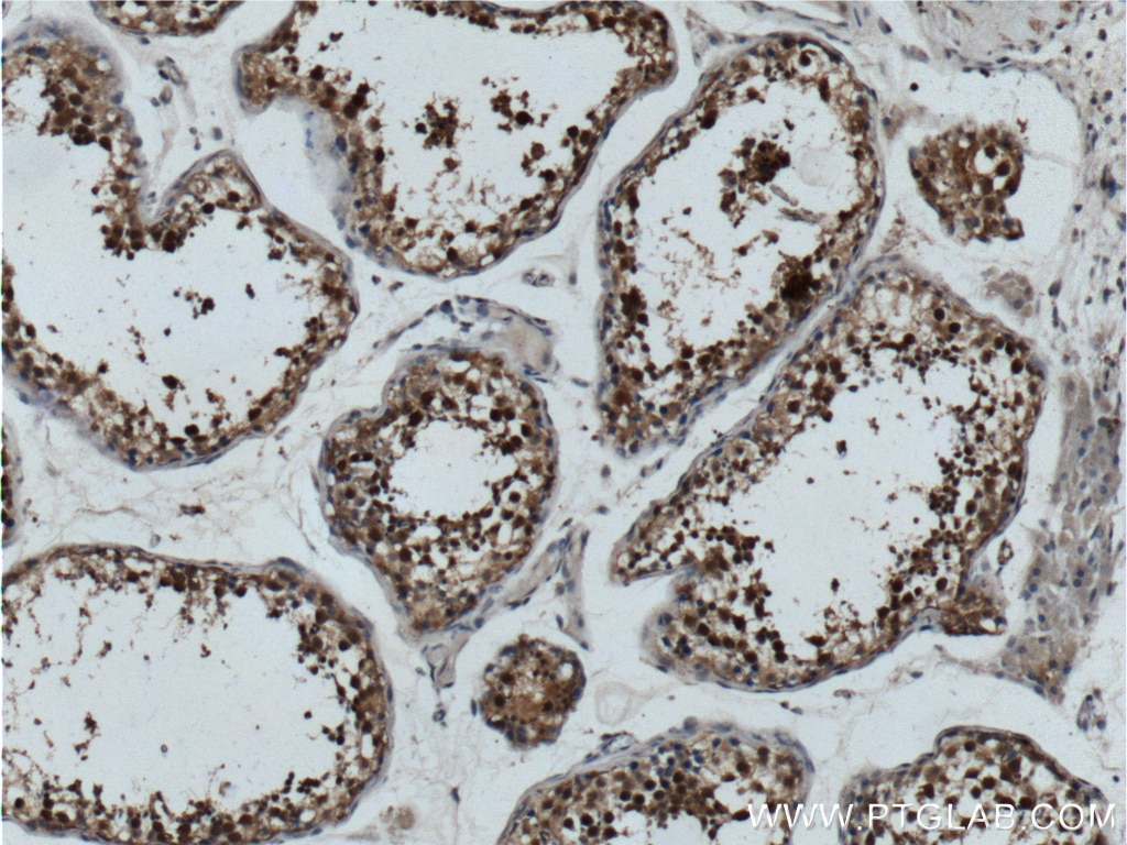 Immunohistochemistry (IHC) staining of human testis tissue using PCBP2 Polyclonal antibody (15070-1-AP)