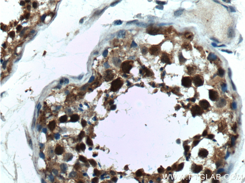 Immunohistochemistry (IHC) staining of human testis tissue using PCBP2 Polyclonal antibody (15070-1-AP)