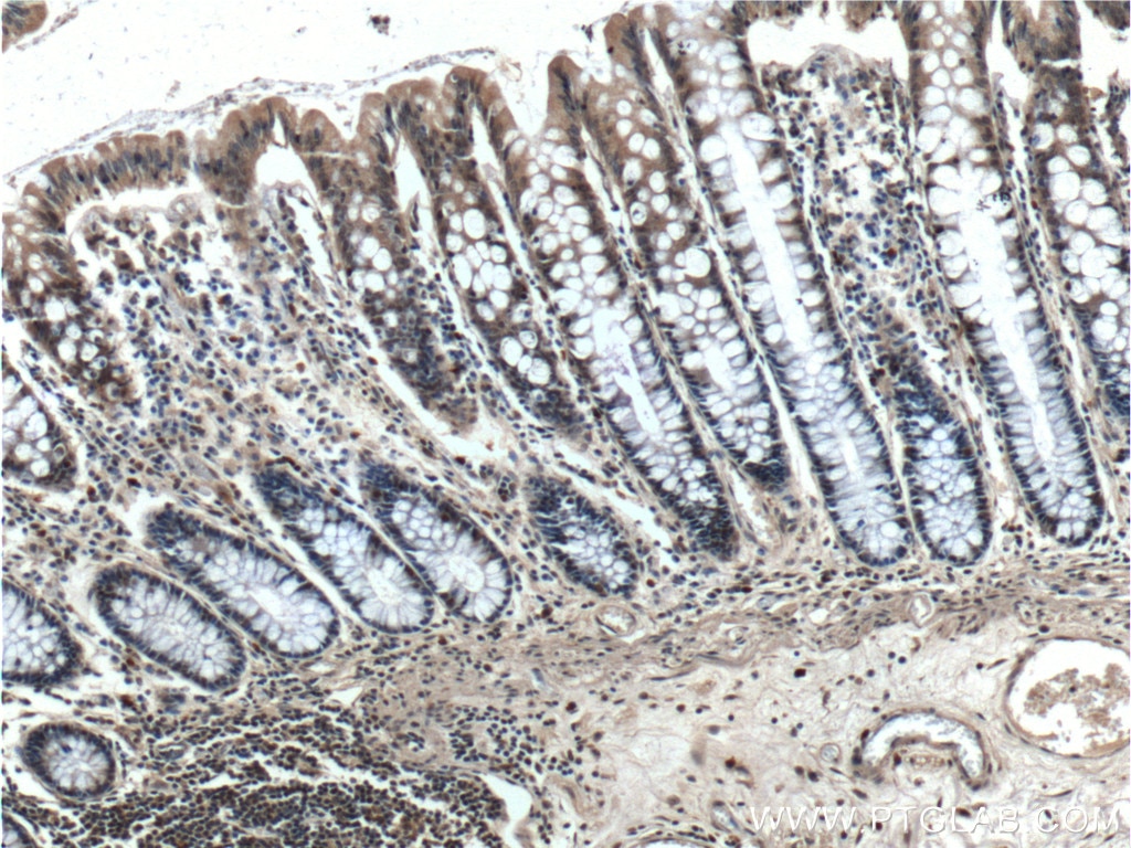 Immunohistochemistry (IHC) staining of human colon tissue using PCBP2 Polyclonal antibody (15070-1-AP)