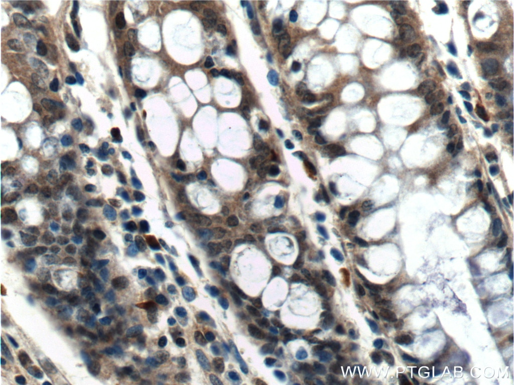 Immunohistochemistry (IHC) staining of human colon tissue using PCBP2 Polyclonal antibody (15070-1-AP)