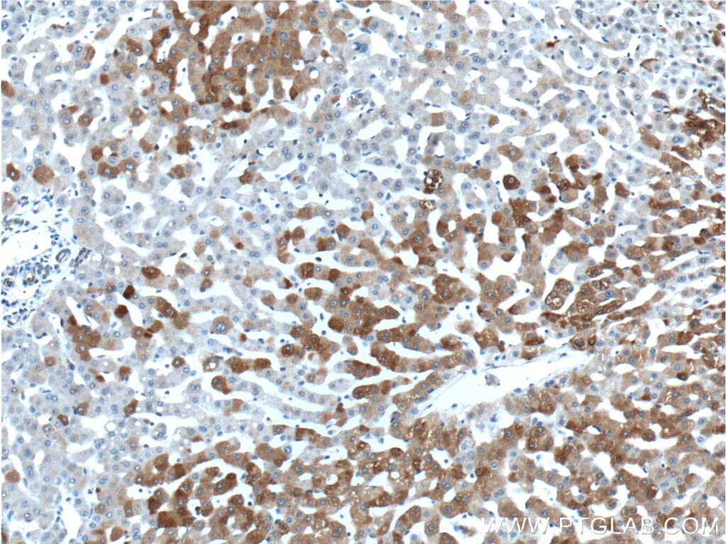 Immunohistochemistry (IHC) staining of human liver tissue using PCBP2 Polyclonal antibody (15070-1-AP)