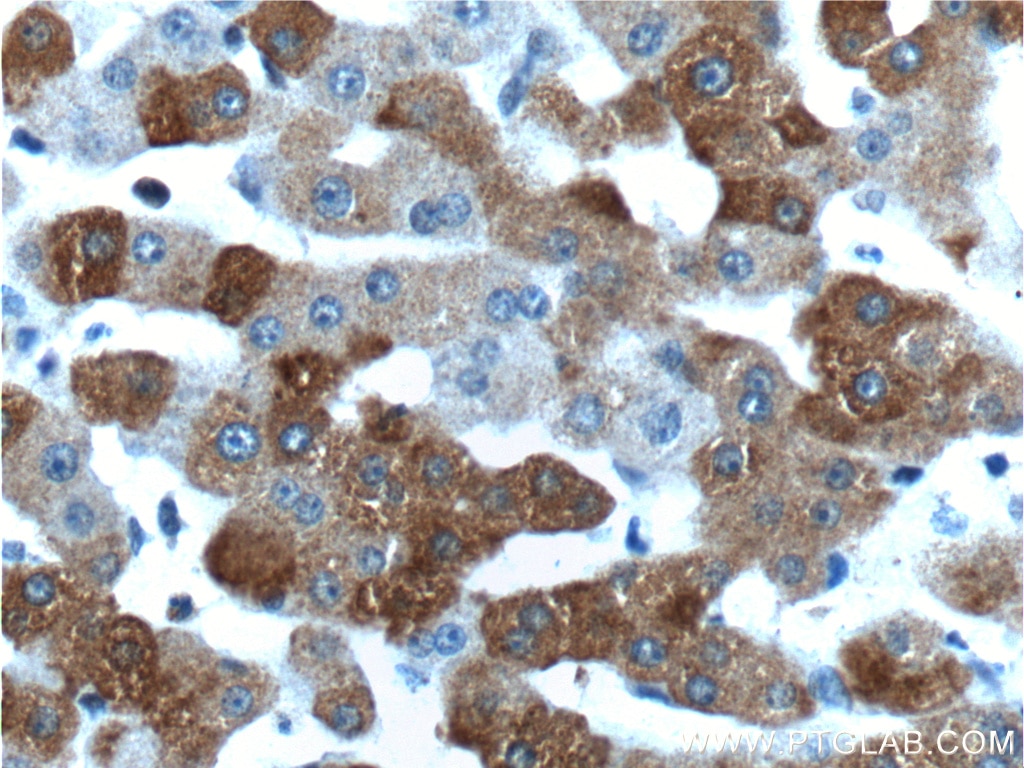 Immunohistochemistry (IHC) staining of human liver tissue using PCBP2 Polyclonal antibody (15070-1-AP)