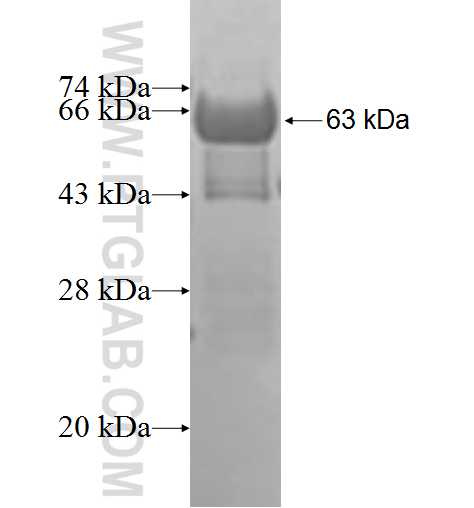 PCBP3 fusion protein Ag9202 SDS-PAGE