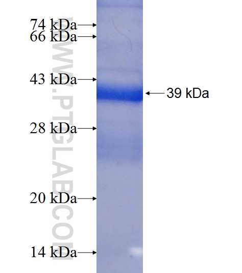PCBP3 fusion protein Ag9318 SDS-PAGE