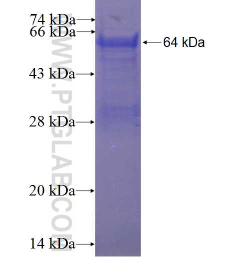 PCBP4 fusion protein Ag1520 SDS-PAGE