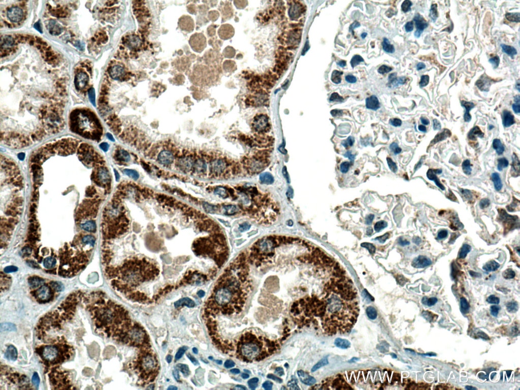 Immunohistochemistry (IHC) staining of human kidney tissue using PCCA Polyclonal antibody (21988-1-AP)
