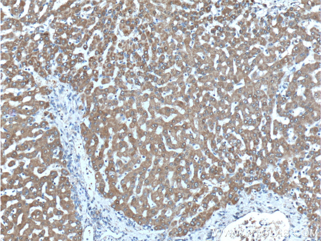 PCCA Polyclonal antibody