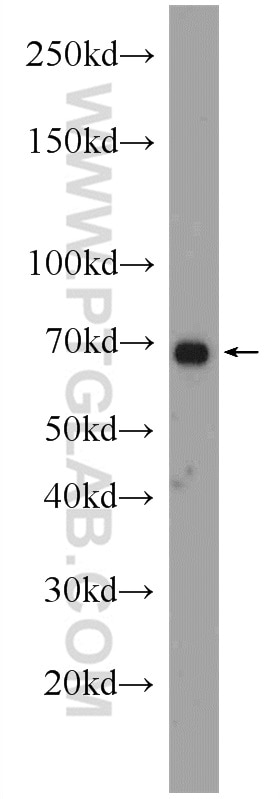 Western Blot (WB) analysis of L02 cells using PCCA Polyclonal antibody (21988-1-AP)