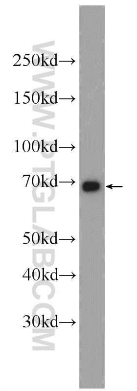 Western Blot (WB) analysis of NIH/3T3 cells using PCCA Polyclonal antibody (21988-1-AP)