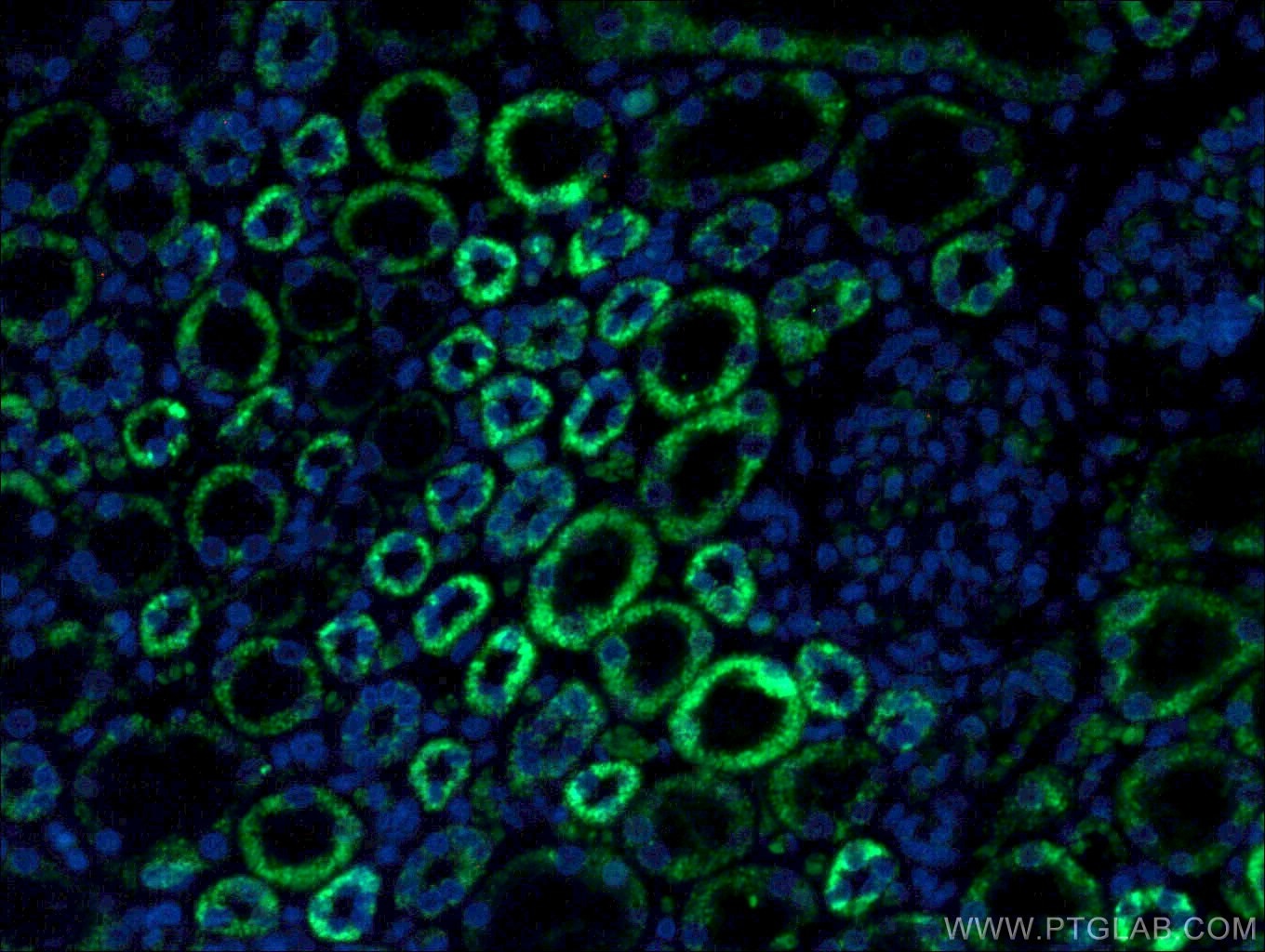 Immunofluorescence (IF) / fluorescent staining of human kidney tissue using PCCB Polyclonal antibody (11139-1-AP)