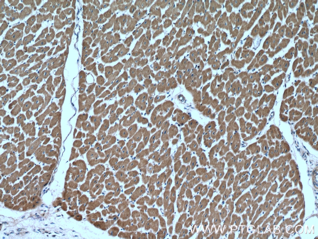 Immunohistochemistry (IHC) staining of human heart tissue using PCCB Polyclonal antibody (11139-1-AP)