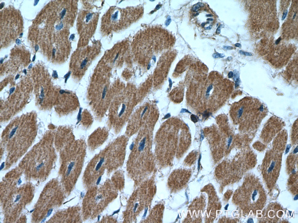 Immunohistochemistry (IHC) staining of human heart tissue using PCCB Polyclonal antibody (11139-1-AP)