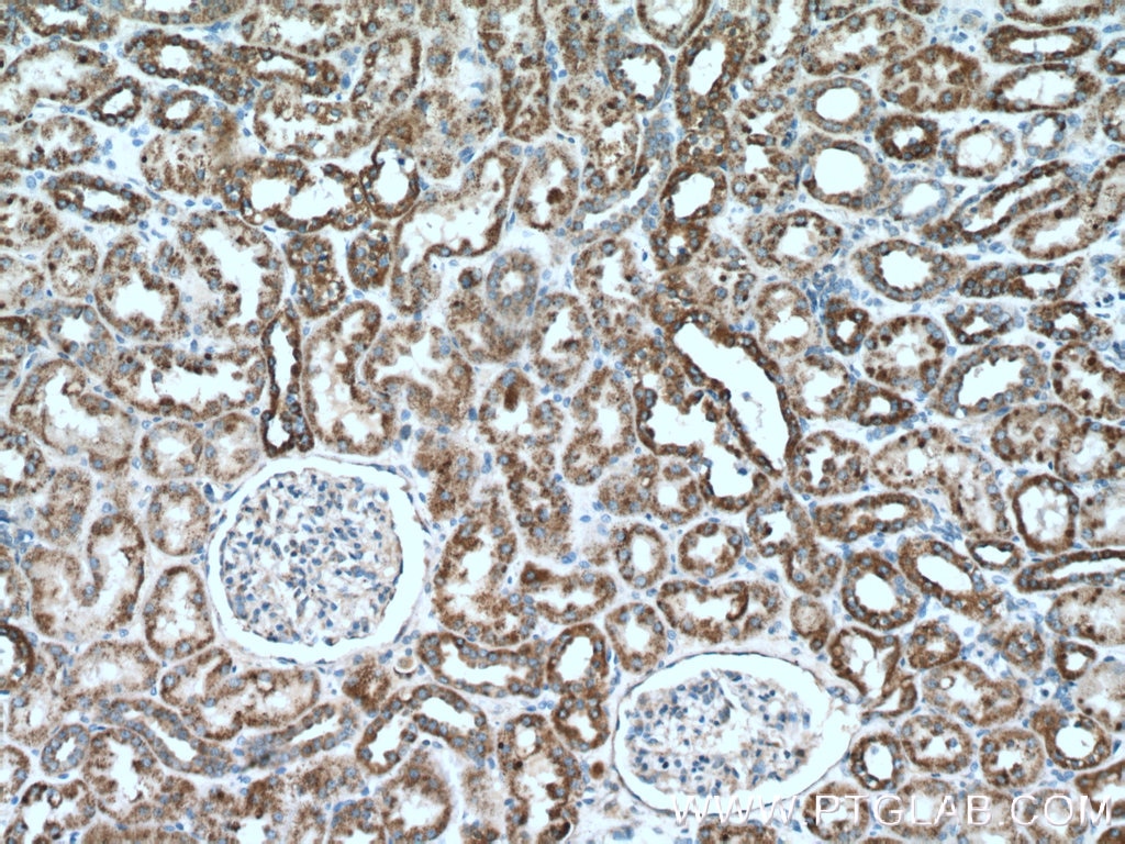 Immunohistochemistry (IHC) staining of human kidney tissue using PCCB Polyclonal antibody (11139-1-AP)
