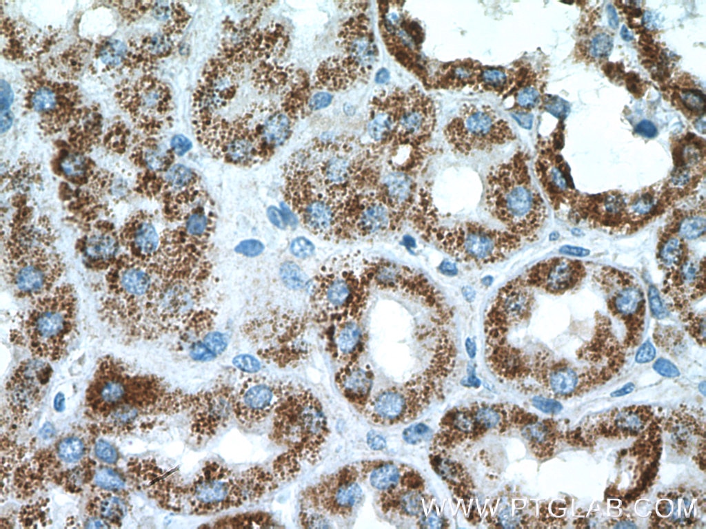 Immunohistochemistry (IHC) staining of human kidney tissue using PCCB Polyclonal antibody (11139-1-AP)