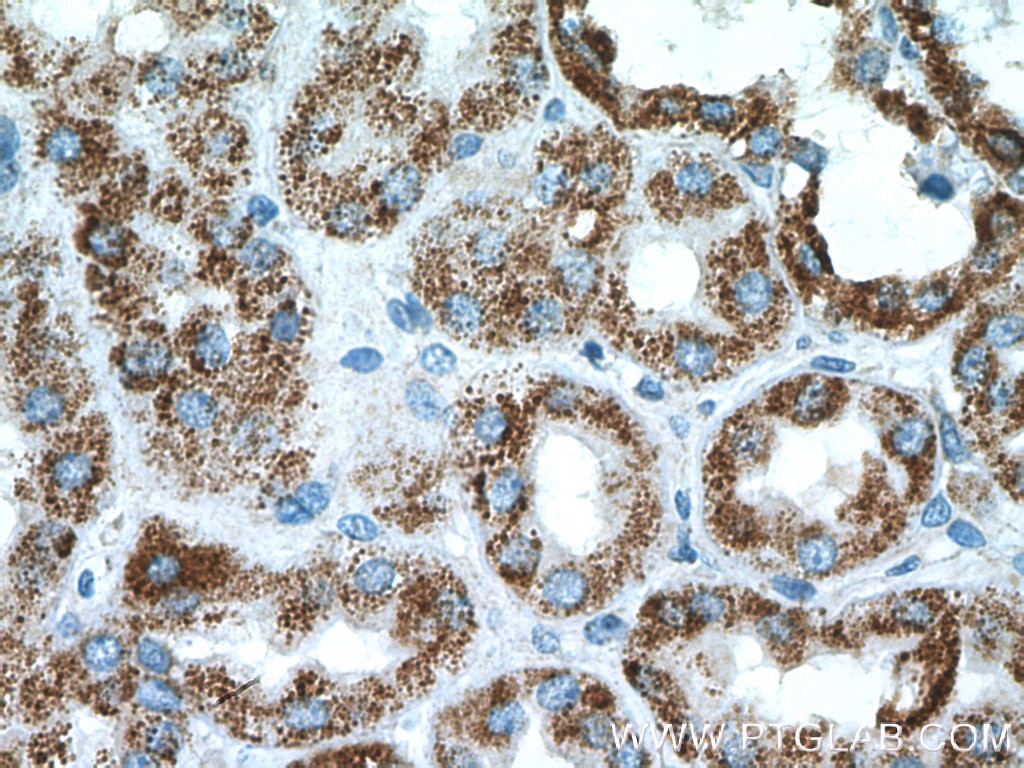 IHC staining of human kidney using 11139-1-AP