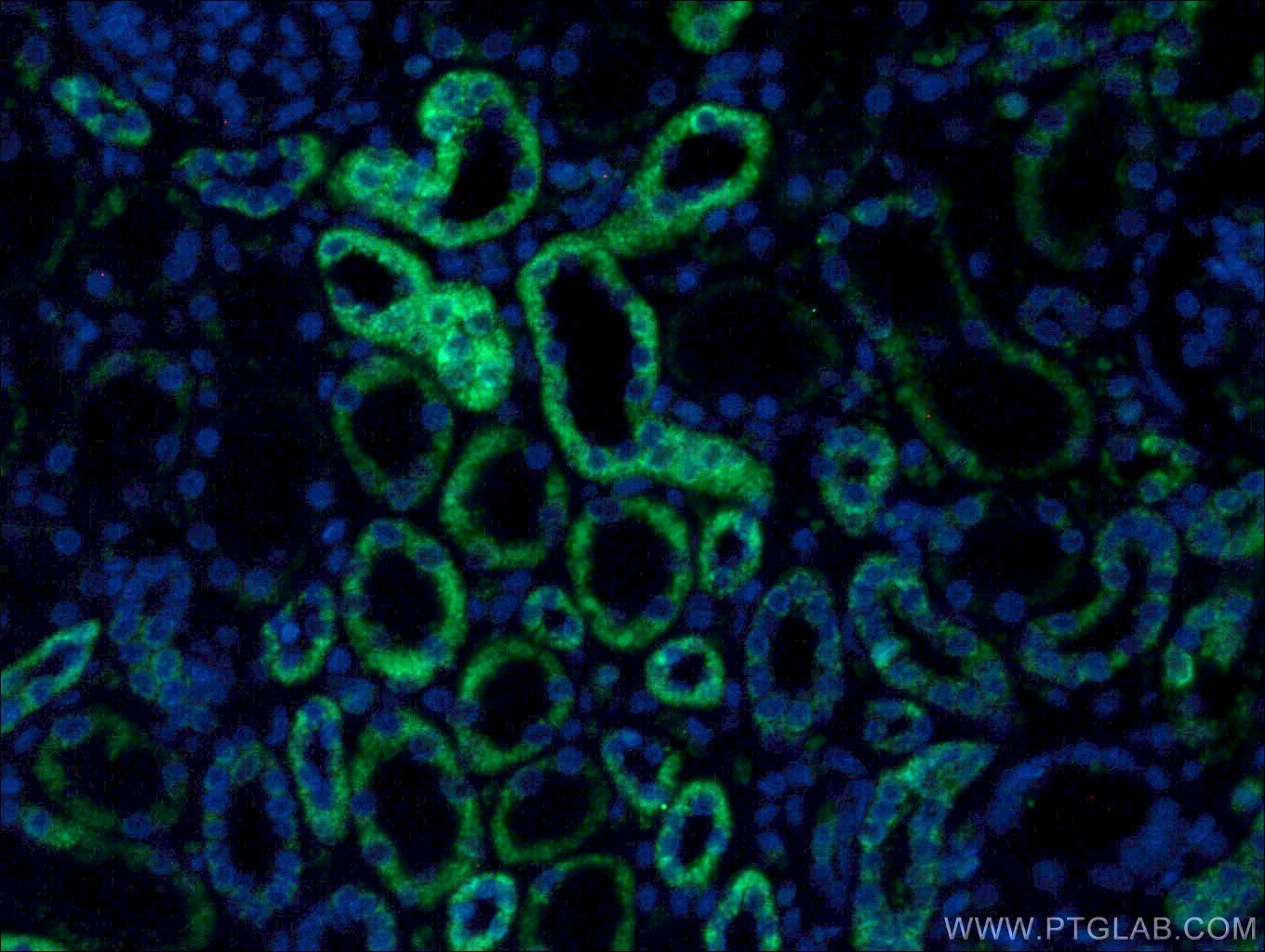 Immunofluorescence (IF) / fluorescent staining of human kidney tissue using PCCB Monoclonal antibody (66501-1-Ig)