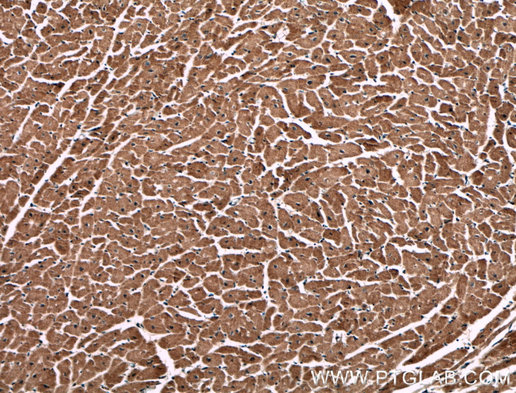 Immunohistochemistry (IHC) staining of human heart tissue using PCCB Monoclonal antibody (66501-1-Ig)