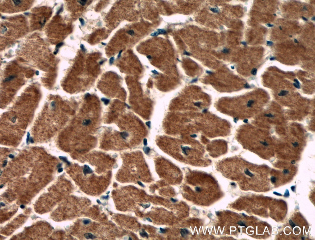 Immunohistochemistry (IHC) staining of human heart tissue using PCCB Monoclonal antibody (66501-1-Ig)