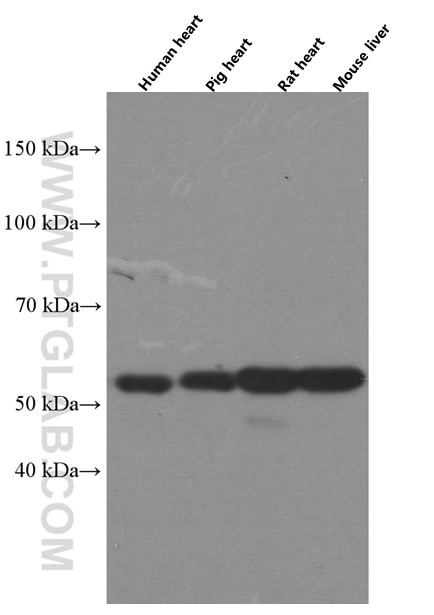 Western Blot (WB) analysis of various lysates using PCCB Monoclonal antibody (66501-1-Ig)