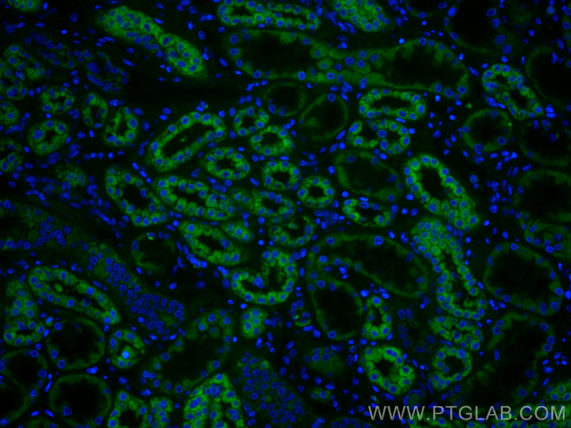 Immunofluorescence (IF) / fluorescent staining of human kidney tissue using CoraLite®488-conjugated PCCB Monoclonal antibody (CL488-66501)