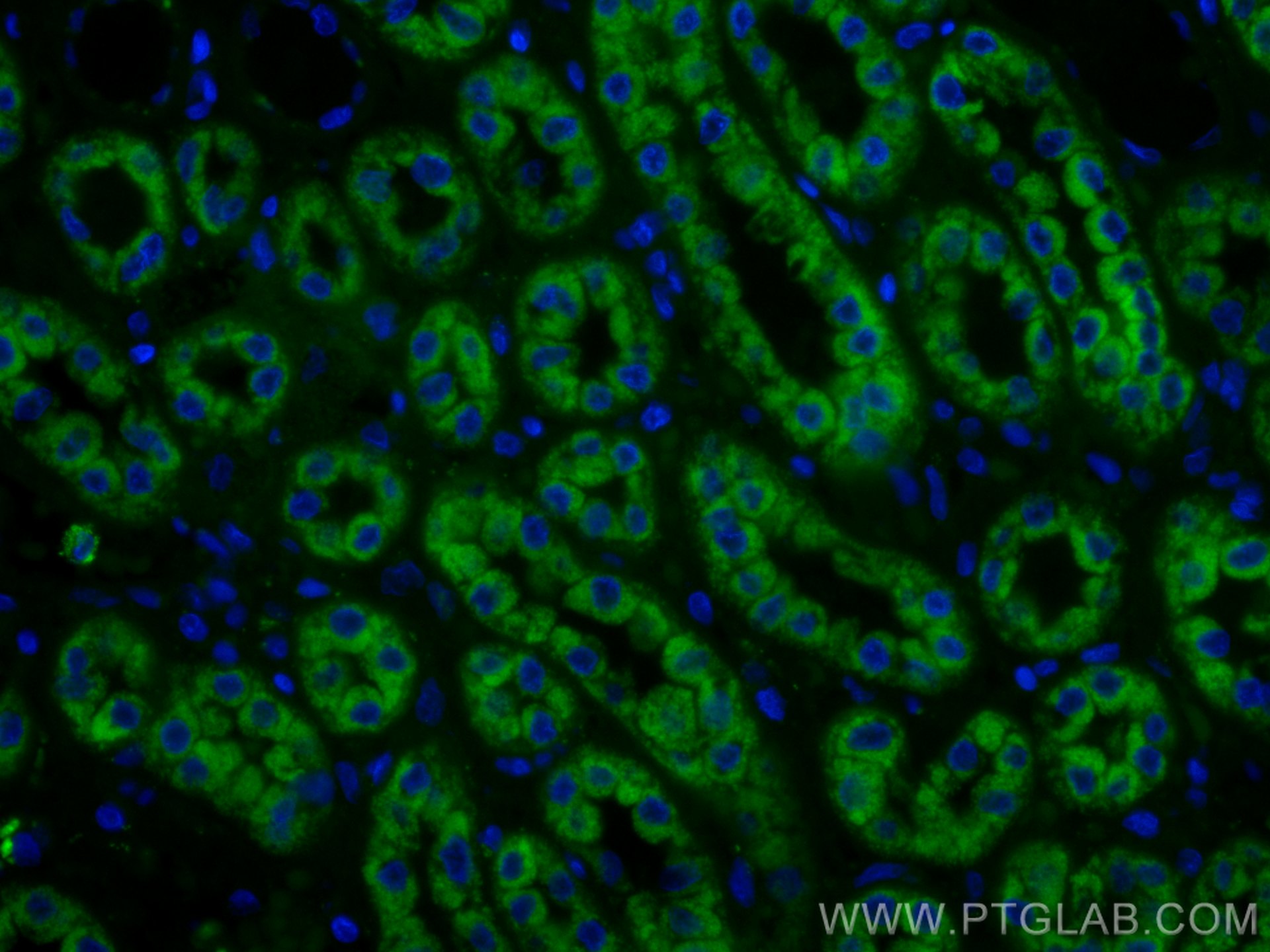 Immunofluorescence (IF) / fluorescent staining of human kidney tissue using CoraLite®488-conjugated PCCB Monoclonal antibody (CL488-66501)