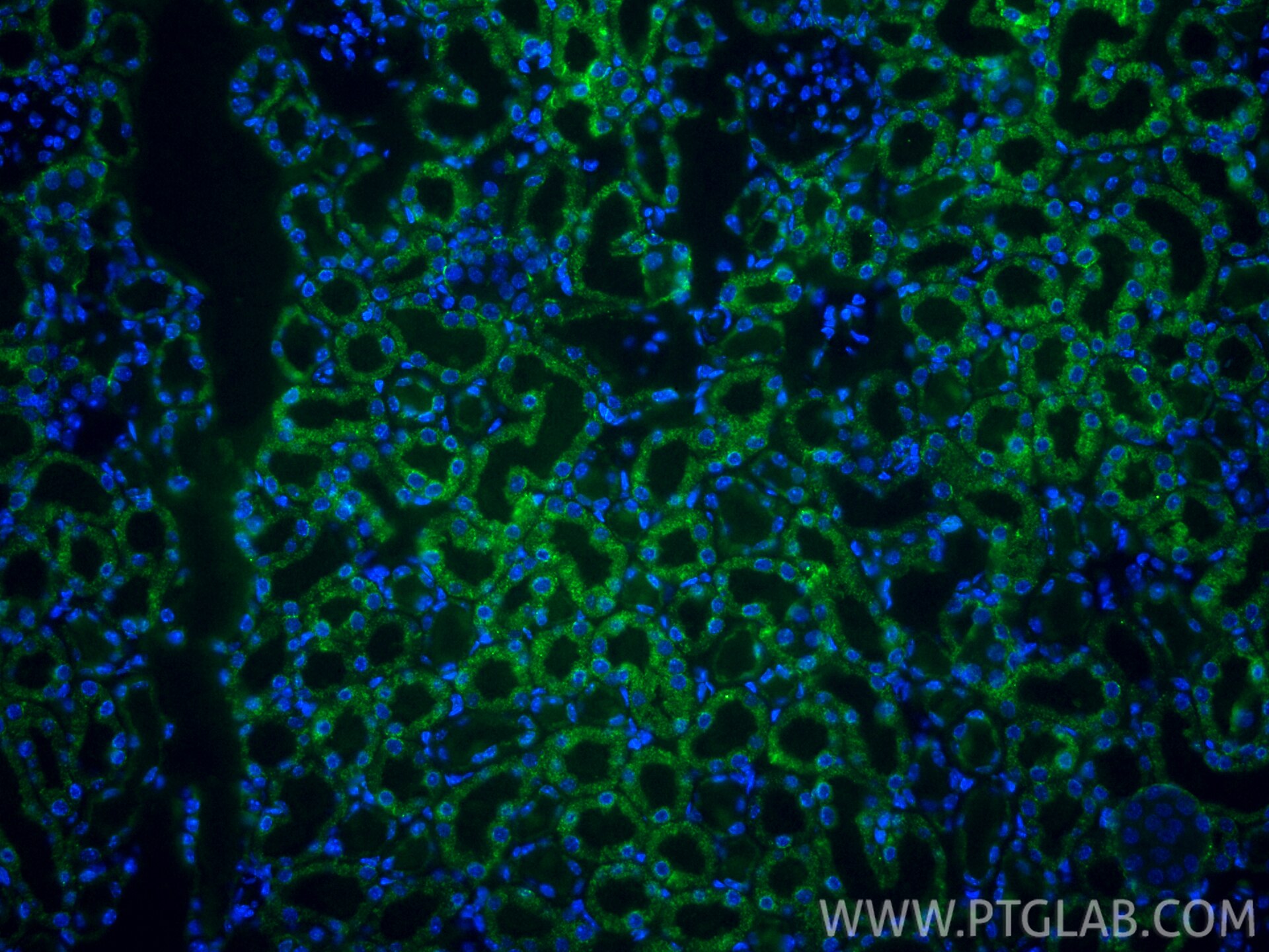 Immunofluorescence (IF) / fluorescent staining of mouse kidney tissue using CoraLite®488-conjugated PCCB Monoclonal antibody (CL488-66501)