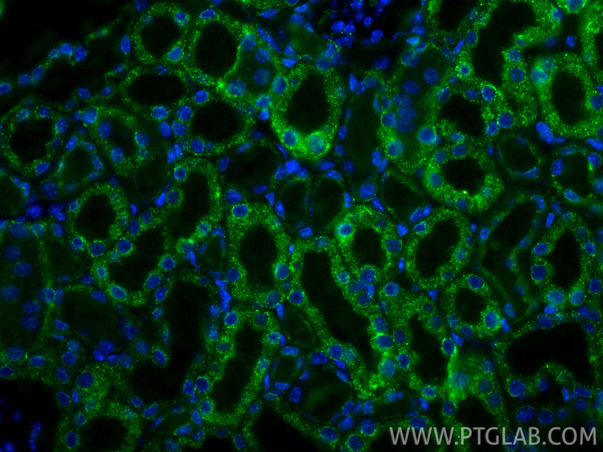 Immunofluorescence (IF) / fluorescent staining of mouse kidney tissue using CoraLite®488-conjugated PCCB Monoclonal antibody (CL488-66501)
