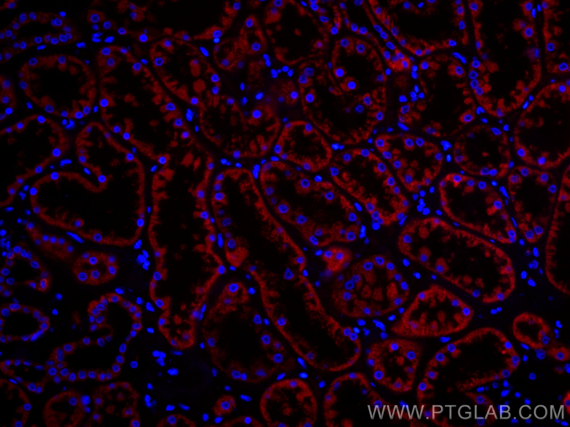 Immunofluorescence (IF) / fluorescent staining of human kidney tissue using CoraLite®594-conjugated PCCB Monoclonal antibody (CL594-66501)
