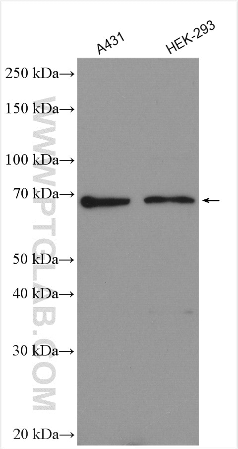 Western Blot (WB) analysis of various lysates using Granulin Polyclonal antibody (10053-1-AP)