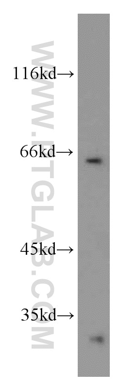 Western Blot (WB) analysis of HEK-293 cells using Granulin Polyclonal antibody (10053-1-AP)