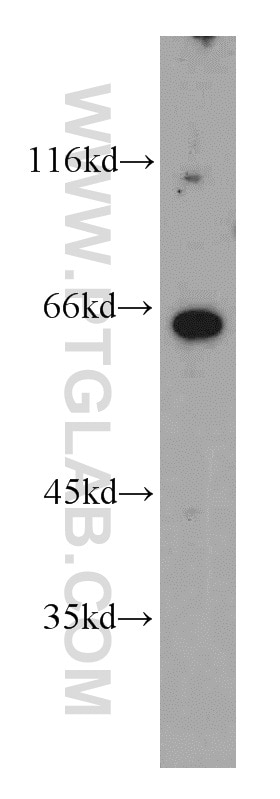 Western Blot (WB) analysis of MCF-7 cells using Granulin Polyclonal antibody (10053-1-AP)