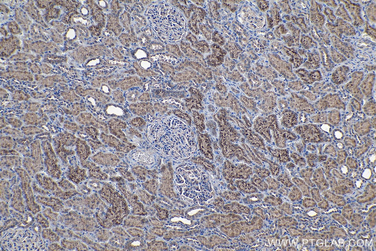 Immunohistochemistry (IHC) staining of human kidney tissue using Granulin Polyclonal antibody (18410-1-AP)