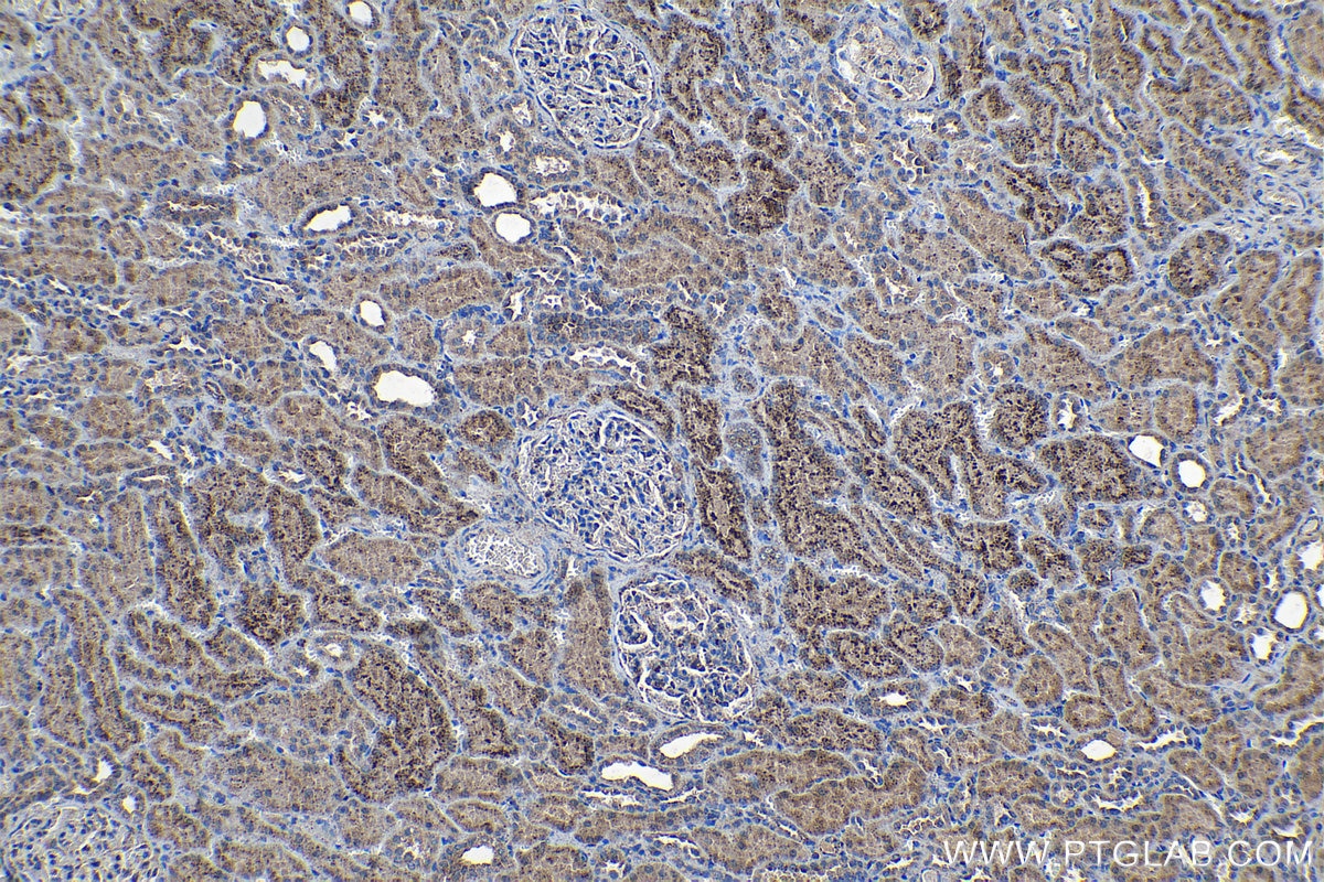 IHC staining of human kidney using 18410-1-AP